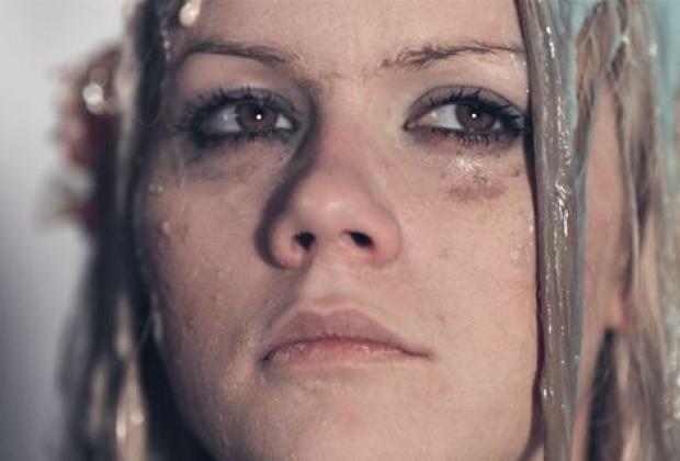 Síndrome. Context, Maneres i estructura.