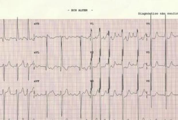Corazón 190, Carolina Bonfim